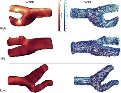 Exploring the Relationships Between Hemodynamic Stresses in the Carotid Arteries